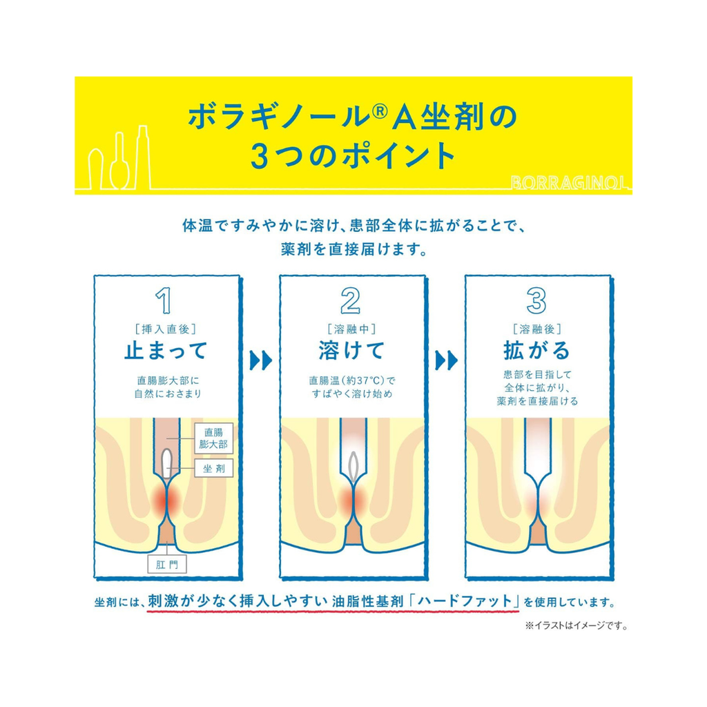 【指定第2類医薬品】ボラギノールA坐剤 30個